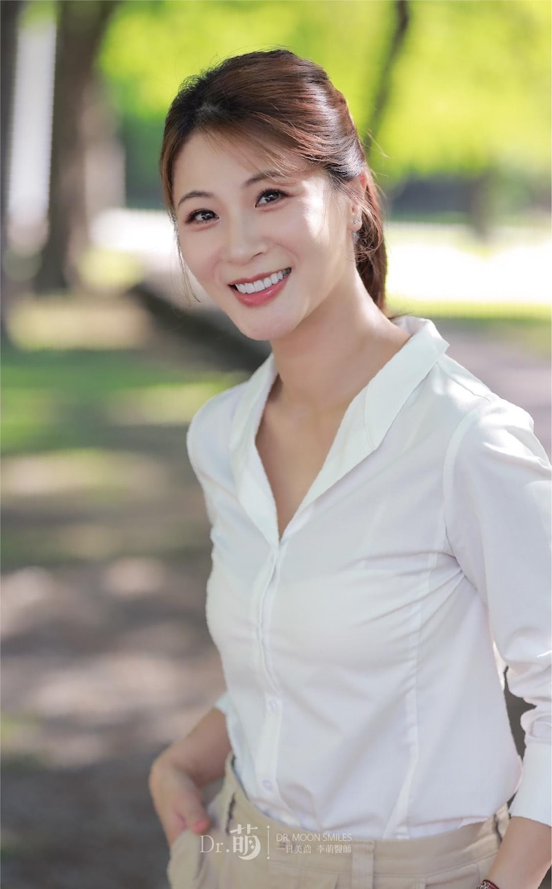 陶瓷貼片完成後笑容，牙齒明亮對稱，散發自然自信感